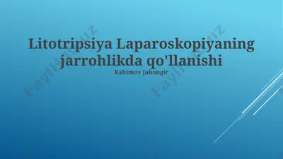 litotripsiya laparoskopiyaning jarrohlikda qo'llanishi — PPTX