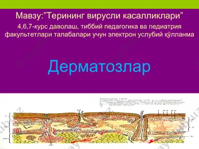 terining virusli kasalliklari-virusli dermatozlar — PPT