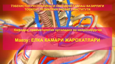 елка камари жарохатлари — PPT