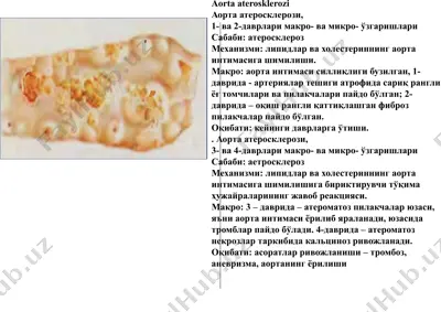 aorta aterosklerozi — PPTX
