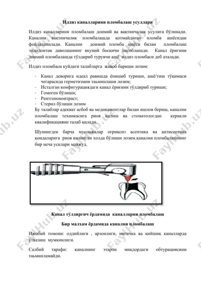 илдиз каналларини пломбалаш усуллари — DOCX