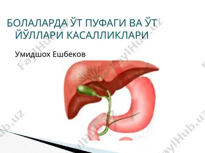 холецистит — PPTX