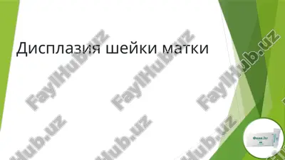 displaziya sheyki matki — PPTX