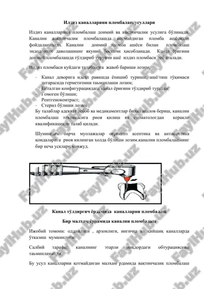 ildiz kanallarini plombalash usullari — DOC