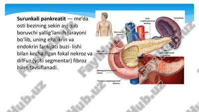 surunkali pankreatit — PDF