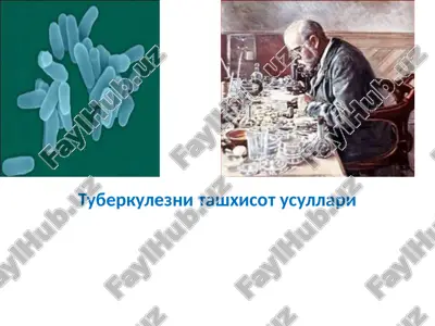 tuberkuleznitashxisotusullari — PPTX
