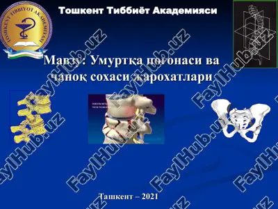 umurtqa pog'onasi va chanoq soxasi jaroxatlari — PPT