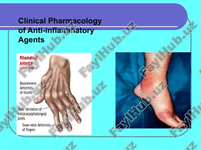 boutonniere deformity — PPT
