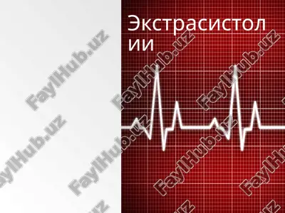 ekstrasistolii — PPT