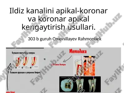 ildiz kanalini apikal-koronar vakoronar apikal kengaytirish usullari — PPTX