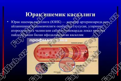 yurak ishemik kasalligi — PPT