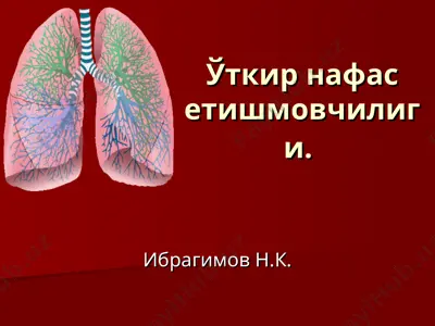 o'tkir nafas etishmovchiligi — PPT