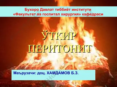 o'tkir peritonit — PPT