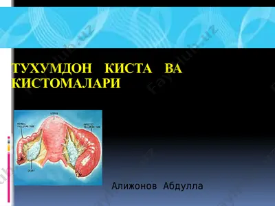 tuxumdon kista va kistomalari — PPTX