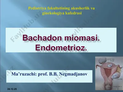 bachadon miomasi — PPT