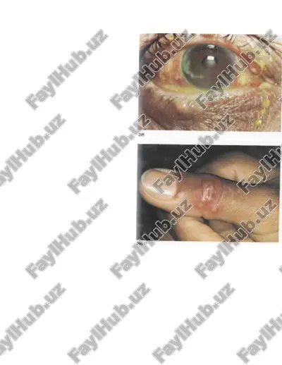 gerpesvirusi — PPTX