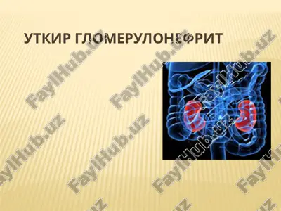 utkirglomerulonefrit — PPTX