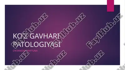 ko’z gavhari patologiyasi — PPTX