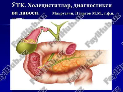 xoletsistitlar, diagnostika va davo — PPT