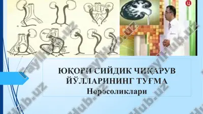 yuqori siydik chiqarish yo'llari norasoliklari — PPTX