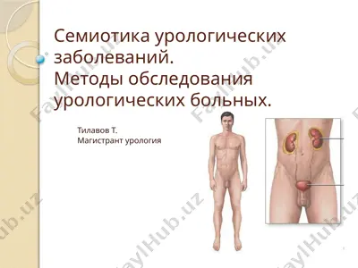 semiotika urologicheskix zabolevaniy.metodi obsledovaniya urologicheskix bolnix — PPT