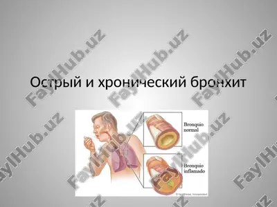 ostriy i xronicheskiy bronxit — PPTX