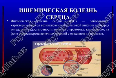 ishemicheskaya bolezn serdtsa — PPT