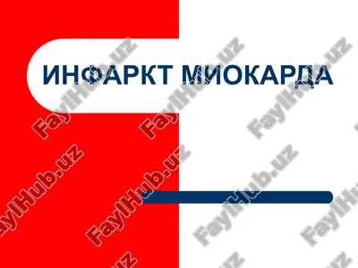 infarkt miokarda — PPTX