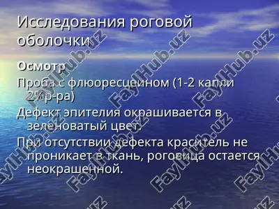 issledovaniya rogovoy obolochki — PPT