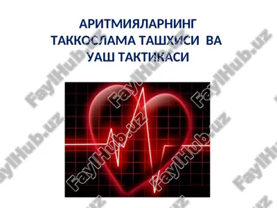 aritmialarni takkoslama tashhisi va uash taktikasi — PPT
