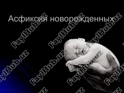 asfiksiya novorojdennix — PPT