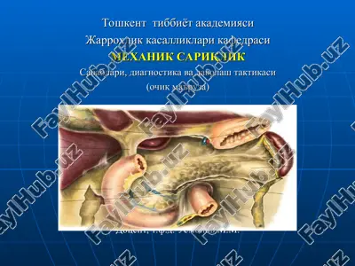 mehanik sariqlik — PPT