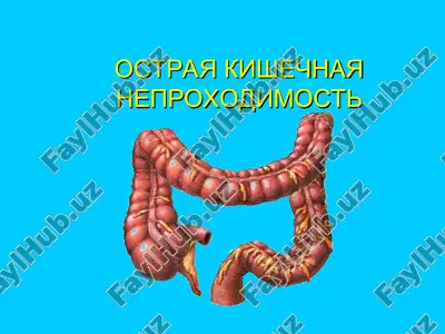 ostriy kishechnaya neproxodimost — PPT
