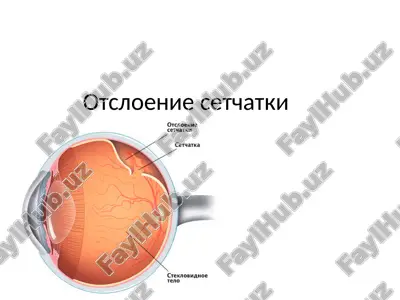otsloenie setchatki — PPTX