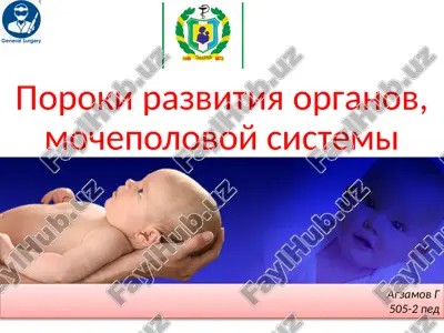 poroki razvitiya organov mochepolovoy sistemi — PPTX