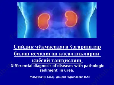 differential diagnosis of diseases with pathologic sediment in urea — PPT