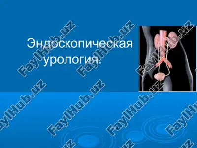 endoskopicheskaya urologiya — PPT