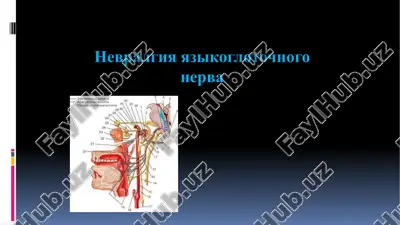 nevralgiya yazikoglotochnogo nerva — PPTX