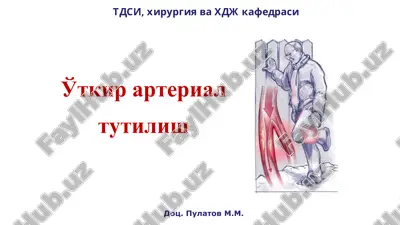 utkir arterial tutilish — PPT