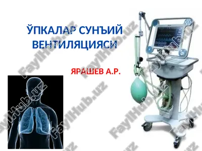 o'pkalar sun'iy ventilyatsiyasi — PPT