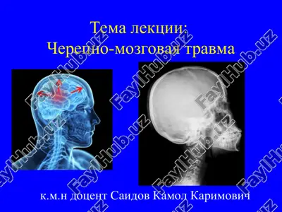 cherepno-mozgovaya travma — PPT