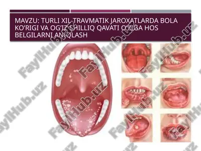 turli xil travmatik jarohatlarda bolak o'rig'i va og'iz shilliq qavati o'ziga hos belgilarni aniqlash — PPTX