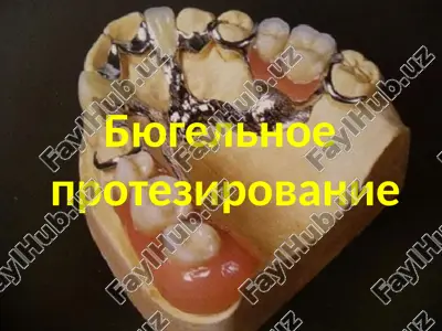 byugelnoe protezirovanie — PPTX