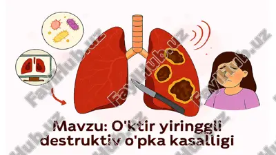 o'ktir yiringgli destruktiv o'pka kasalligi — PPTX
