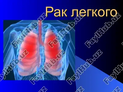 rak legkogo — PPT