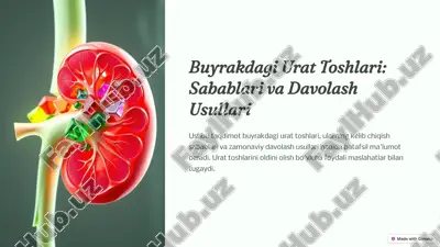 urat toshlari: sabablari va davolash usullari — PPTX