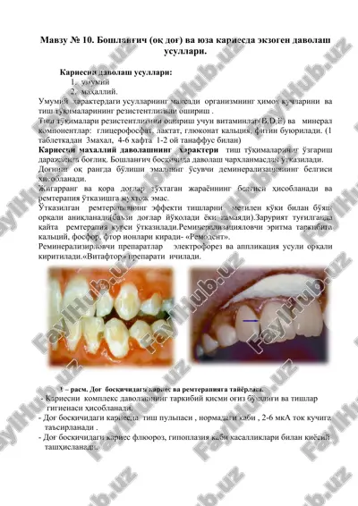 kariesni davolash usullari — DOCX