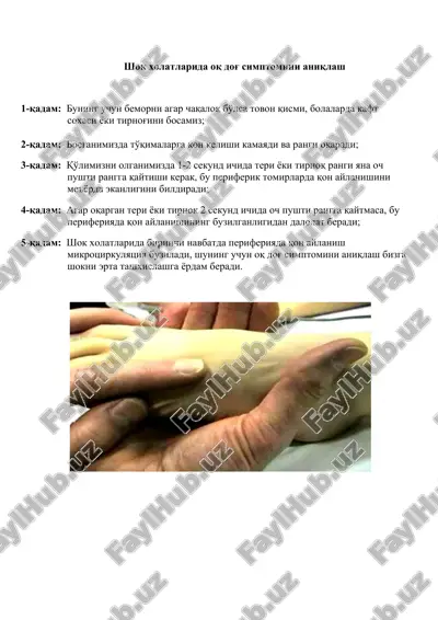 shok xolatlarida oq dog' simptomini aniqlash — DOCX