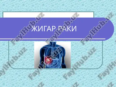 jigar raki — PPT