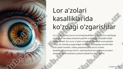 lor a'zolari kasalliklarida ko'zdagi o'zgarishlar — PPTX